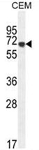 AP50167PU-N - Alpha-amylase 2B