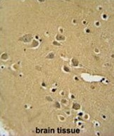 AP50167PU-N - Alpha-amylase 2B