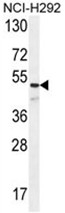 AP50175PU-N - Angiopoietin-1