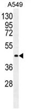 AP50176PU-N - Angiopoietin-2