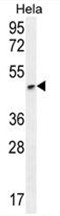 AP50177PU-N - Angiopoietin-3