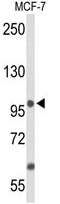 AP50192PU-N - Anoctamin-7 / ANO7