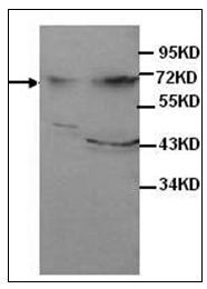 AP31741PU-N - Alpha-fetoprotein / AFP