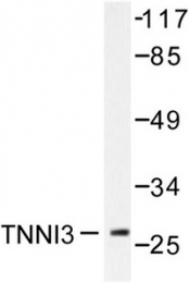 AP06439PU-N - Cardiac Troponin I