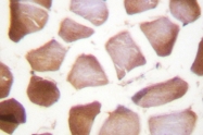 AP06439PU-N - Cardiac Troponin I