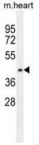 AP50198PU-N - AP1 complex subunit mu-1 / AP1M1