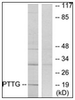 AP31754PU-N - PTTG1IP