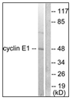AP31751PU-N - Cyclin E1