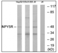 AP31755PU-N - NPY Receptor 5 / NPY5R