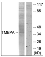 AP31759PU-N - PMEPA1 / STAG1