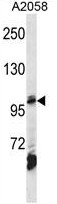 AP50201PU-N - AP2 complex subunit beta-1 / AP2B1