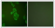AP31758PU-N - Neuron specific enolase