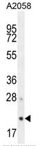 AP50203PU-N - AP3 complex subunit sigma-1 / AP3S1