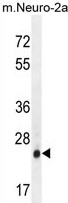 AP50203PU-N - AP3 complex subunit sigma-1 / AP3S1