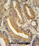 AP50203PU-N - AP3 complex subunit sigma-1 / AP3S1