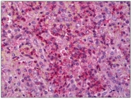 AP31764PU-N - CD126 / IL6R