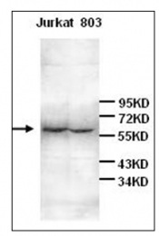 AP31764PU-N - CD126 / IL6R