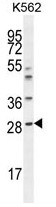 AP50206PU-N - Serum amyloid P-component