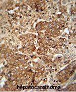 AP50206PU-N - Serum amyloid P-component