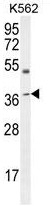 AP50213PU-N - Apolipoprotein L6 / APOL6