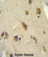 AP50213PU-N - Apolipoprotein L6 / APOL6