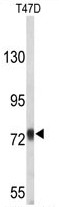 AP50216PU-N - Amyloid beta A4 protein / APP