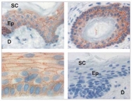 BM6031P - Plakophilin 3 / PKP3