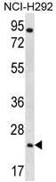 AP50221PU-N - Aquaporin-5 / AQP5