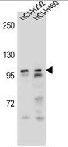 AP50224PU-N - Androgen receptor