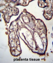 AP50226PU-N - Arfaptin-1
