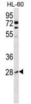 AP50230PU-N - RhoB