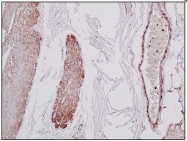 DB 001-IHC-0.2 - pan Actin
