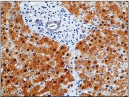 DB 003-IHC-0.1 - NOS2