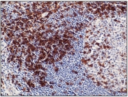 DB 027-1 - CD5