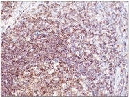 DB 042-1 - CD45 / LCA