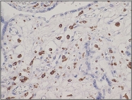 DB 045-1 - CD163