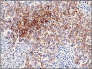 DB 047-0.5 - Alkaline phosphatase / PLAP / ALPP