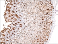 DB 048-0.1 - CD227 / Mucin-1 / MUC1