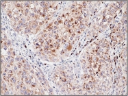 DB 049-0.1 - Melanoma gp100