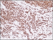 DB 053-0.5 - Estrogen receptor alpha