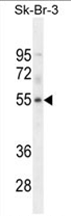 AP54535PU-N - DCAF4L1 / WDR21B