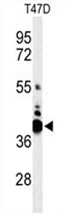 AP54528PU-N - VTCN1 / B7H4