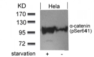 AP09467PU-S - Catenin alpha-1 / CTNNA1