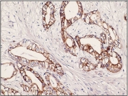 DB 051-0.5 - Cytokeratin 7