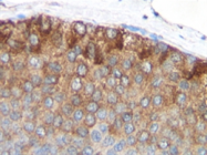 SM2289P - MCP1 / CCL2