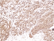 DB 059-1 - Progesterone receptor