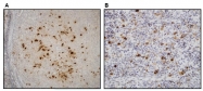 DB 060-1 - Epstein Barr Virus / EBV