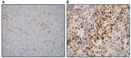 DB 061-0.1 - Epstein Barr Virus / EBV