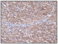 DB 062-1 - CD117 / c-kit