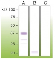 DB 081-0.05 - CD230 / PrP